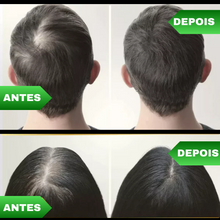 Carregar imagem no visualizador da galeria, Tônico Capilar 7 Days® - NutriCresce
