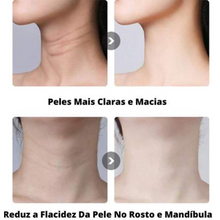 Carregar imagem no visualizador da galeria, Removedor de Rugas, Acne e Marcas de Expressões Profissional Elétrico
